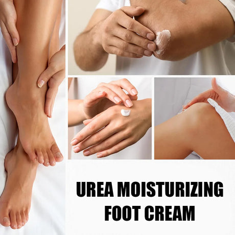 Urea 40% Cream Foot Cream for Dry Cracked Feet Heels Knees Hands Repair Treatment,Moisturizer Dead Skin Remover Foot Cream