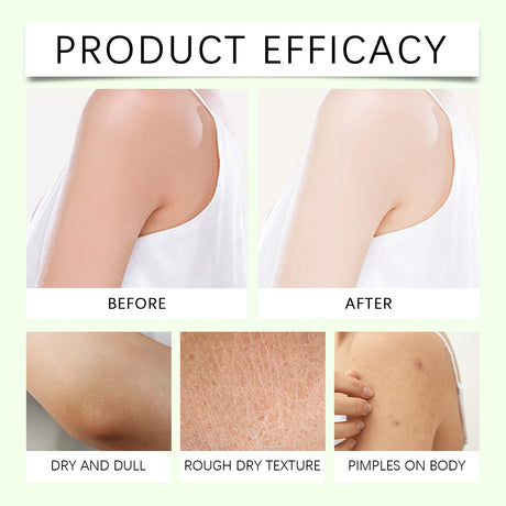 Shea Butter Body Lotion Moisturizing Magnesium Body Butter Nourishing Skin Soft Smooth Soothes Muscles Body Skincare Cream