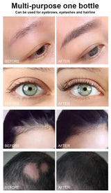 Fast Eyebrow Growth Serum Eyelash Hair Growth Anti Hairs Loss Product Prevent Baldness Fuller Thicker Lengthening Eyebrow Makeup