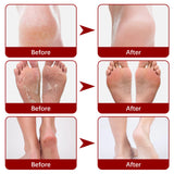 Exfoliating Feet Mask Sock Exfoliation Scrub for Feet Mask Remove Dead Skin Moisturizing Pedicure Anti Crack Foot Patch Spa 5PCS
