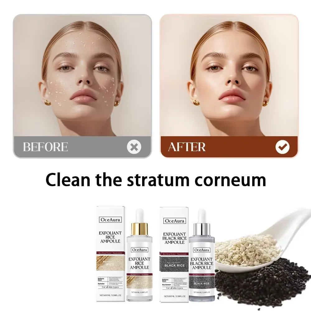Black&White Rice Exfoliating Essence Dead Skin Remover Facial Glowing Replenisning Shrink Pore Hyaluronic Acid Brightening Serum