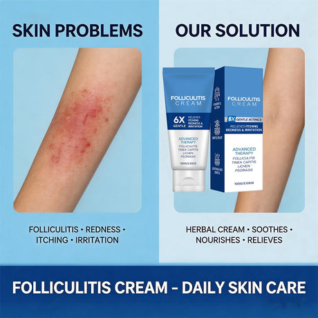 Folliculitis Cream Reduce Redness Relieve Itching Soothing Stimulating Herbal Gentle Smoothing Nourishing Care Cream
