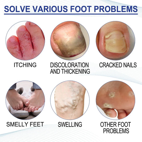 Foot Soaking Salts Pedicure Foot Softening Soak Pedicure Foot Soak Foots 10pcs Organic Foot Softening Capsule Shape Up Care