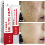 Whitening Freckles Face Cream Removal Melasma Dark Spots Corrector Lighten Melanin Pigmentation Brighten Anti-Aging Beauty Care