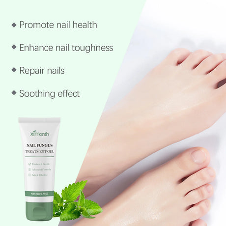 Nail Fungal Treatment Ointment Anti Infection Paronychia Onychomycosis Soft Hand Feet Toenail Repair Damaged Health Care Cream