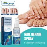 South Moon Foot Spray Anti Smell Remove Toenail Fungal Paronychia Onychomycosis Care Deodorant Antiperspirant Nail Repair Spray