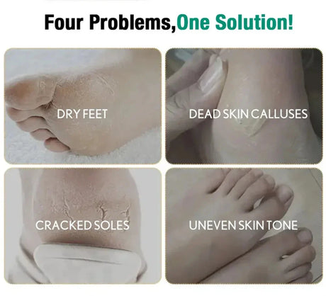 Herbal Anti Crack Foot Cream Spray Heel Cracking Repair Products Exfoliation Dead Skin Removal Softening Moisturize Smooth Care