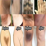 Whitening Cream For Dark Skin Underarm Bleaching Armpit Lightening And Intimate Area Woman Moisturizer Korean Skin Care Products
