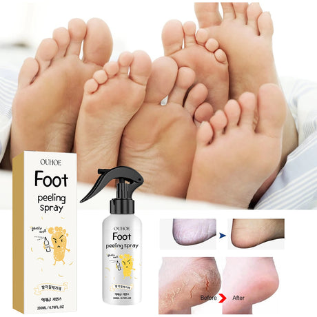 Ouhoe Foot Exfoliating Spray 72H Moisture Lock Callus Softener Anti Dry Crack Repair Odor Control Brightening Foot Care Liquid