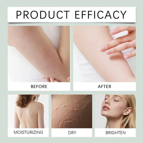 Hyaluronic Acid Body Serum Deep Hydrating Body Lotion for Smoother Plumper Looking Skin Lightweight Fast-Absorbing Body Care