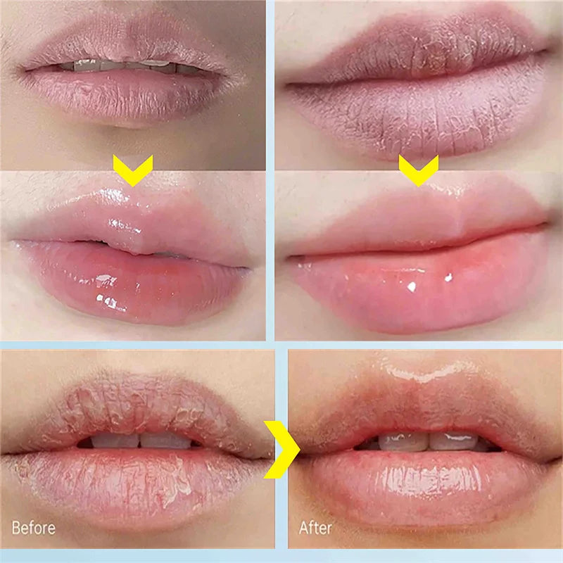 Soothing Lip Mask Hydrating Repair Lip Balm For Dry Lips Anti-Chapping Lip Care Stick Lip Lines Pigmentation Moisturizing 10ml