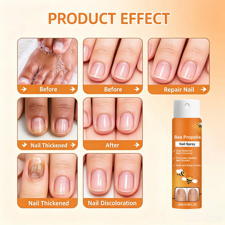 Bee Venom Nail Soothing Spray Nail Repair Treatment for Damaged&Discolored Toenail Moisturizing Nourishing Care for Brittle Nail