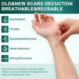 Silicone Scar Sheets - Reusable Scar Tape for Keloid, C-Section, Surgery, Burn, Acne - Waterproof, Hypoallergenic, Latex-Free