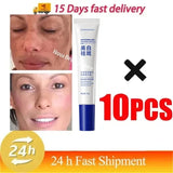 Powerful Spot-Removing Whiten Cream Brighten Skin Fast Eliminates Melanin Pigmentation Melasma Dark Spots Korean Face Skin Care