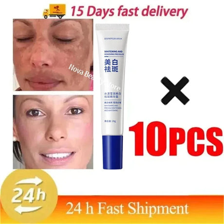 Powerful Spot-Removing Whiten Cream Brighten Skin Fast Eliminates Melanin Pigmentation Melasma Dark Spots Korean Face Skin Care