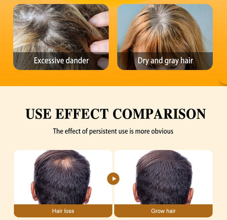 Batana Oil Hair Growth Products Fast Growth Batana Essence Oil Traction Alopecia Anti Hair Loss Baldness Treatment For Men Women