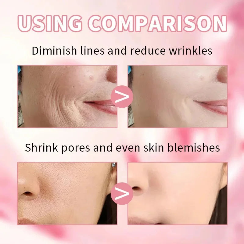 Niacinamide Dark Spot Remove Serum Face Freckle Melanin Correcting Moisturizing Brightening Anti Pigmentation Repair Skin Care