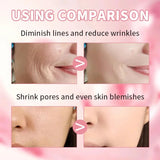 Niacinamide Dark Spot Remove Serum Face Freckle Melanin Correcting Moisturizing Brightening Anti Pigmentation Repair Skin Care