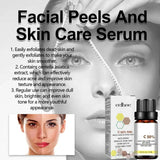 High Quality 50% Chemical Peel Acid Skin Superforce Pigmentation Lightening Melanin Acne Treatment Remove Scar