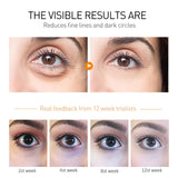 OCHEAL Eye Moisturizing Cream Fades Fine Lines Anti Dark Circles Eye Serum Remove Eye Bag Puffiness Anti-Aging Firmness Eye Care