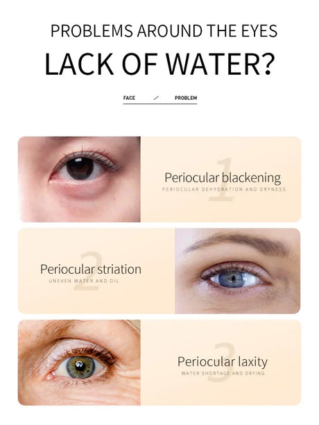 BIOAOUA Rice Whitening Eye Cream Moisturizing Reduce Dark Circles Lift Firm Brightening 20g