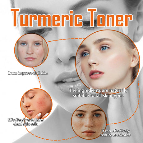 Turmeric Toner Dark Spots Removal Brightening Spots Corrector Remove Freckle Fade Melasma Moisturizing Turmeric Face Toner