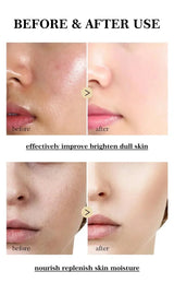 Dark Spots Remover Whitening Face Set Freckle Melanin Correcting Reduce Fine Lines Brighten Essence Korean Beauty Skin Care ﻿