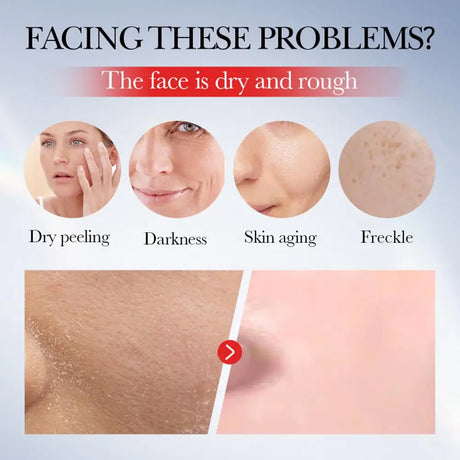 SADDER Kojic Acid Face Cream for Dark Spots Freckles Skin Care with Vitamin C, Whitening Treatment, Overnight Repair Moisturizer