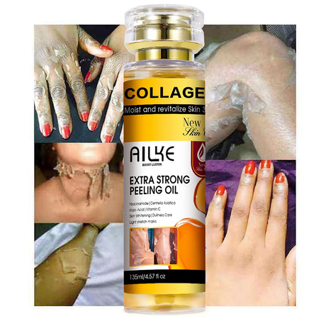 AILKE Collagen Yellow Peeling Oil For All Skin Types, Stretch Mark Removal, Lightening , Improve Rough Skin, Gentle Exfoliation