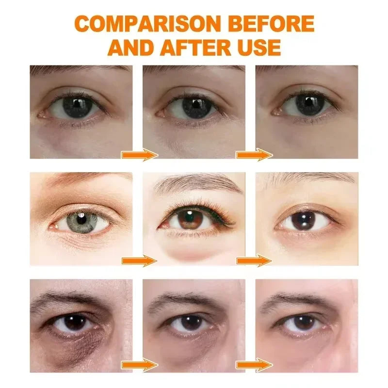 Anti Dark Circle Eye Serum Oil Retinol Anti Wrinkle Firming Lift Skin Remove Eyes Bag Fade Fine Line Whitening Brighten Eye Care