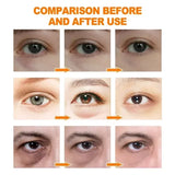 Anti Dark Circle Eye Serum Oil Retinol Anti Wrinkle Firming Lift Skin Remove Eyes Bag Fade Fine Line Whitening Brighten Eye Care