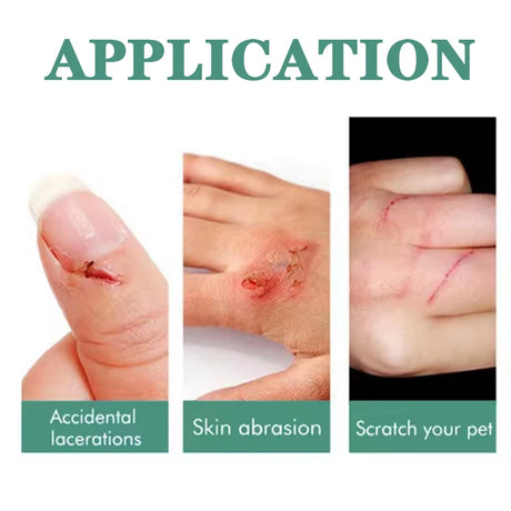 Nail Disinfection Hemostatic Agent Genuine Goods Stopping Blood Tool for Manicure Beauty