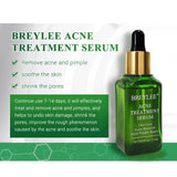 BREYLEE Tea Tree Essence Face Cream Acne Patch 4-Piece Set, Balances Oil And Water, Treats Acne
