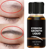 Eyelash & Eyebrow Growth Serum – Prevents breakage, delivers fuller results in 7 days, ideal for daily eye care.