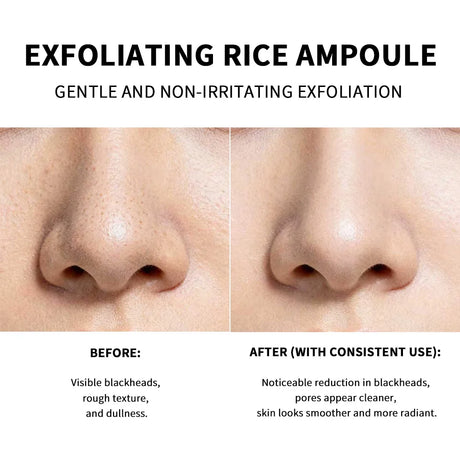 Rice Peeling Ampoule Soft Exfoliating Face and Body Scrub Dead Skin Cells Blackhead Remover for All Skin Types  korean skin care