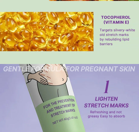Stretch Marks Repair Cream Fade Lines Improve Duliness Tightness Long-lasting Moisturizing Smooth Enhance Elasticity Body Care