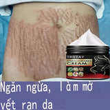 TRSTAY Stretch Mark Cream for Pregnancy Skin Replenish And Repair Cell Growth Promotion Maternity Striae Gravidarum Care