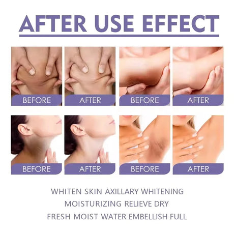 Body Whitening Cream Private Parts Underarm Bleaching Serum Whiten Butt Knee Brighten Inner Thigh Intimate Dark Remove Melanin