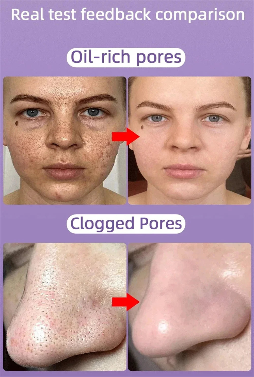 Salicylic Acid Pore Shrinking Cream Quick Elimination Large Pores Remove Blackehead Tighten Face Smooth Skin Korean Care Product