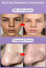 Salicylic Acid Pore Shrinking Cream Quick Elimination Large Pores Remove Blackehead Tighten Face Smooth Skin Korean Care Product