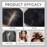 Polygonum Multiflorum Hair Care Spray Biotin Nourishes Scalp Strengthens Hair Roots Smoothing Hair Care Essence Conditioner