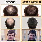 Biotin fast Hair Growth oil Products Care Scalp Massage Treatments Anti Hair Loss Effective Grow Thicker Hair serum for men