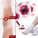 Exfoliating Feet Mask Sock Exfoliation Scrub for Feet Mask Remove Dead Skin Moisturizing Pedicure Anti Crack Foot Patch Spa 5PCS