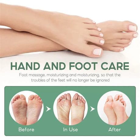 Herbal Anti Crack Foot Cream Spray Heel Cracking Repair Products Exfoliation Dead Skin Removal Softening Moisturize Smooth Care
