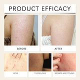 Ximonth Skin Soothing Spray Relieves Redness Itching Nourishes Moisturizes Soothes Skin Non Irritating Gentle Repair Skin Care