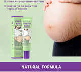 Stretch Marks Repair Cream Fade Lines Improve Duliness Tightness Long-lasting Moisturizing Smooth Enhance Elasticity Body Care