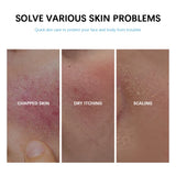 Soothing Multi-Purpose Hydrating Cream Reduces Redness Daily Helps Relieve Rough Cracked Skin Deep Skin Care