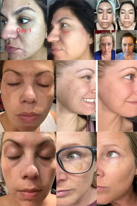 Dark Spots Removal Cream Facial Whitening Freckle Acne Mark Pigmentation Removal Melanin Skin Correction Brighten Care Products