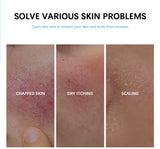 Facial Redness Repair Cream Improve Sensitive Skin Dryness Hydrating Sooth Lotion Removal Rosacea Day Night Korean Cosmetics