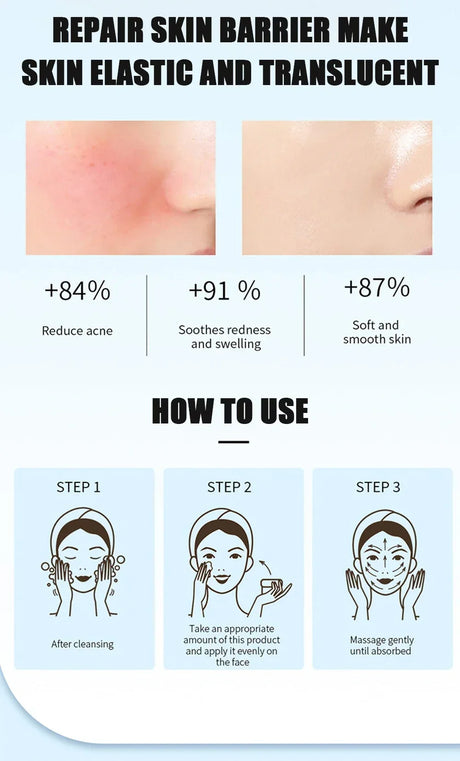 Face Serum Fruit Acid Acne Treatment Oil Control Remove Blackheads Shrink Pores Skin Texture Improve Care